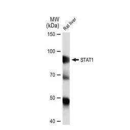 Anti-STAT1 antibody [GT1157] used in Western Blot (WB). GTX01292