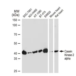 Anti-Casein Kinase 2 alpha antibody [GT1233] used in Western Blot (WB). GTX01541