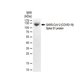 SARS-CoV-2 (COVID-19) Spike S1 protein, His and Avi tag (active). GTX01548-pro