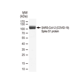 SARS-CoV-2 (COVID-19) Spike S1 protein, His tag (active). GTX01554-pro