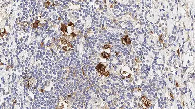 Anti-CD30 antibody [JCM182] used in IHC (Paraffin sections) (IHC-P). GTX01872