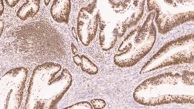 Anti-MLH1 antibody [ES05] used in IHC (Paraffin sections) (IHC-P). GTX01906