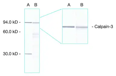 Anti-Calpain 3 antibody [Calp3c/12A2] used in Western Blot (WB). GTX01970