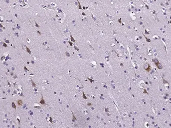 Anti-TNF Receptor I antibody used in IHC (Paraffin sections) (IHC-P). GTX02170