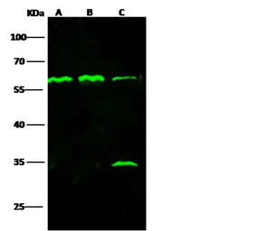 Anti-TNF Receptor I antibody used in Western Blot (WB). GTX02170