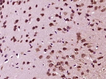 Anti-GDNF antibody used in IHC (Paraffin sections) (IHC-P). GTX02540