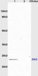 Anti-GDNF antibody used in Western Blot (WB). GTX02540