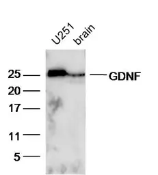 Anti-GDNF antibody used in Western Blot (WB). GTX02540