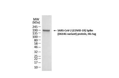 SARS-CoV-2 (COVID-19) Spike (D614G Mutant)(ECD) protein, His tag (active). GTX02575-pro