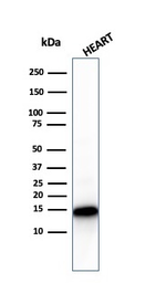 Anti-Cytochrome C antibody [CYCS/3128R] used in Western Blot (WB). GTX02626