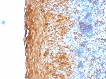 Anti-Involucrin antibody [IVRN/2113R] used in IHC (Paraffin sections) (IHC-P). GTX02654