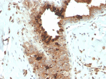 Anti-Mammaglobin A antibody [MGB/4057R] used in IHC (Paraffin sections) (IHC-P). GTX02706