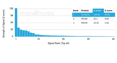 Anti-Mammaglobin A antibody [MGB/4057R] used in Protein Array (Protein Array). GTX02706