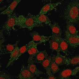 Anti-B7-H4 antibody [B7H4/2652R] used in Immunocytochemistry/ Immunofluorescence (ICC/IF). GTX02741