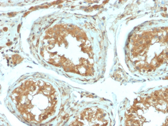 Anti-B7-H4 antibody [B7H4/2652R] used in IHC (Paraffin sections) (IHC-P). GTX02741