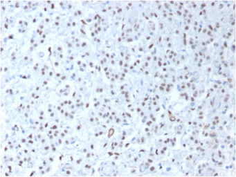 Anti-Wilms Tumor 1 antibody [WT1/1434R] used in IHC (Paraffin sections) (IHC-P). GTX02743