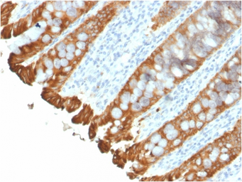 Anti-Cytokeratin 8 + 18 antibody [KRT8.18/2297R] used in IHC (Paraffin sections) (IHC-P). GTX02751