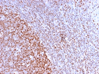 Anti-Nuclear Antigen antibody [NM2984R] used in IHC (Paraffin sections) (IHC-P). GTX02768