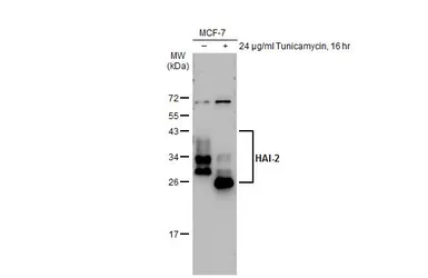 Anti-HAI-2 antibody [XY9] used in Western Blot (WB). GTX02801