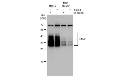 Anti-HAI-2 antibody [XY9] used in Western Blot (WB). GTX02801