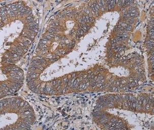 Anti-ZC3H12A antibody used in IHC (Paraffin sections) (IHC-P). GTX02811