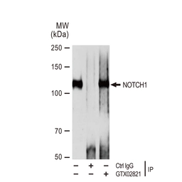 Anti-NOTCH1 antibody [GT1224] used in Immunoprecipitation (IP). GTX02821