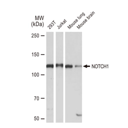 Anti-NOTCH1 antibody [GT1224] used in Western Blot (WB). GTX02821