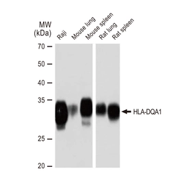 Anti-HLA-DQA1 antibody [GT1231] used in Western Blot (WB). GTX02828