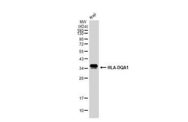 Anti-HLA-DQA1 antibody [GT1231] used in Western Blot (WB). GTX02828