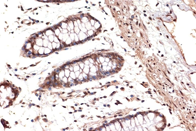 Anti-DDX17 antibody [GT1254] used in IHC (Paraffin sections) (IHC-P). GTX02851