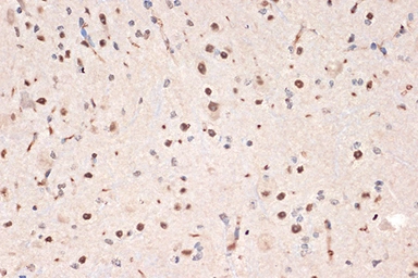 Anti-DDX17 antibody [GT1254] used in IHC (Paraffin sections) (IHC-P). GTX02851