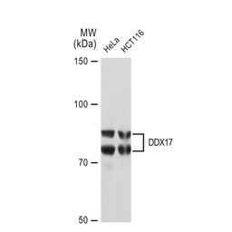 Anti-DDX17 antibody [GT1254] used in Western Blot (WB). GTX02851