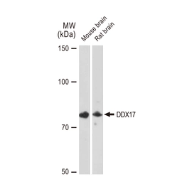 Anti-DDX17 antibody [GT1254] used in Western Blot (WB). GTX02851