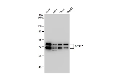 Anti-DDX17 antibody [GT1254] used in Western Blot (WB). GTX02851