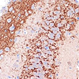 Anti-CDH13 antibody [GT1255] used in IHC (Paraffin sections) (IHC-P). GTX02852