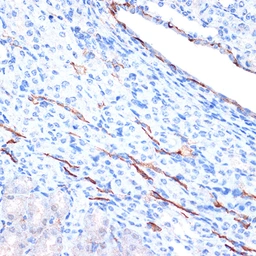 Anti-CDH13 antibody [GT1255] used in IHC (Paraffin sections) (IHC-P). GTX02852