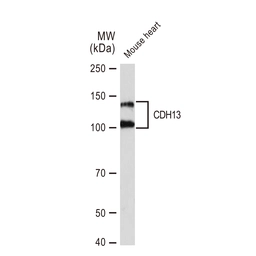 Anti-CDH13 antibody [GT1255] used in Western Blot (WB). GTX02852