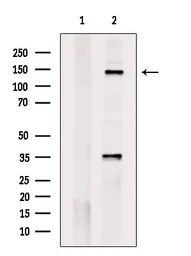 Anti-c-Met (phospho Tyr1234) antibody used in Western Blot (WB). GTX02868