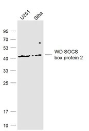 Anti-WSB2 antibody used in Western Blot (WB). GTX03039