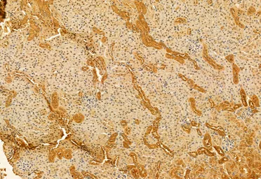 Anti-SMCR7L antibody used in IHC (Paraffin sections) (IHC-P). GTX03170