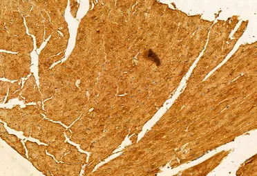 Anti-SMCR7L antibody used in IHC (Paraffin sections) (IHC-P). GTX03170