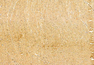 Anti-SMCR7L antibody used in IHC (Paraffin sections) (IHC-P). GTX03170