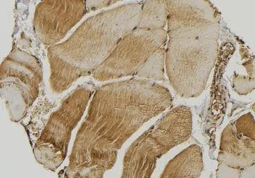 Anti-SMCR7L antibody used in IHC (Paraffin sections) (IHC-P). GTX03170