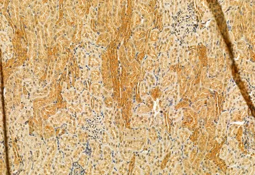 Anti-SMCR7L antibody used in IHC (Paraffin sections) (IHC-P). GTX03170