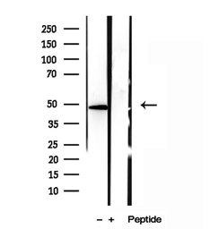 Anti-SMCR7L antibody used in Western Blot (WB). GTX03170