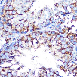 Anti-mAChR M2 antibody [GT1272] used in IHC (Paraffin sections) (IHC-P). GTX03184