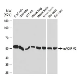 Anti-mAChR M2 antibody [GT1272] used in Western Blot (WB). GTX03184