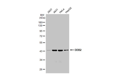 Anti-DDB2 antibody [GT1277] used in Western Blot (WB). GTX03189