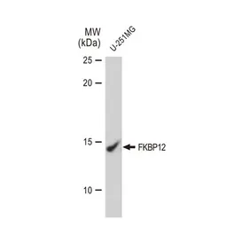 Anti-FKBP12 antibody [GT1281] used in Western Blot (WB). GTX03193