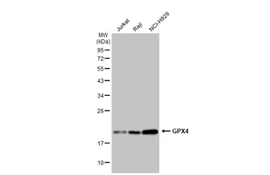 Anti-GPX4 antibody [GT1282] used in Western Blot (WB). GTX03194